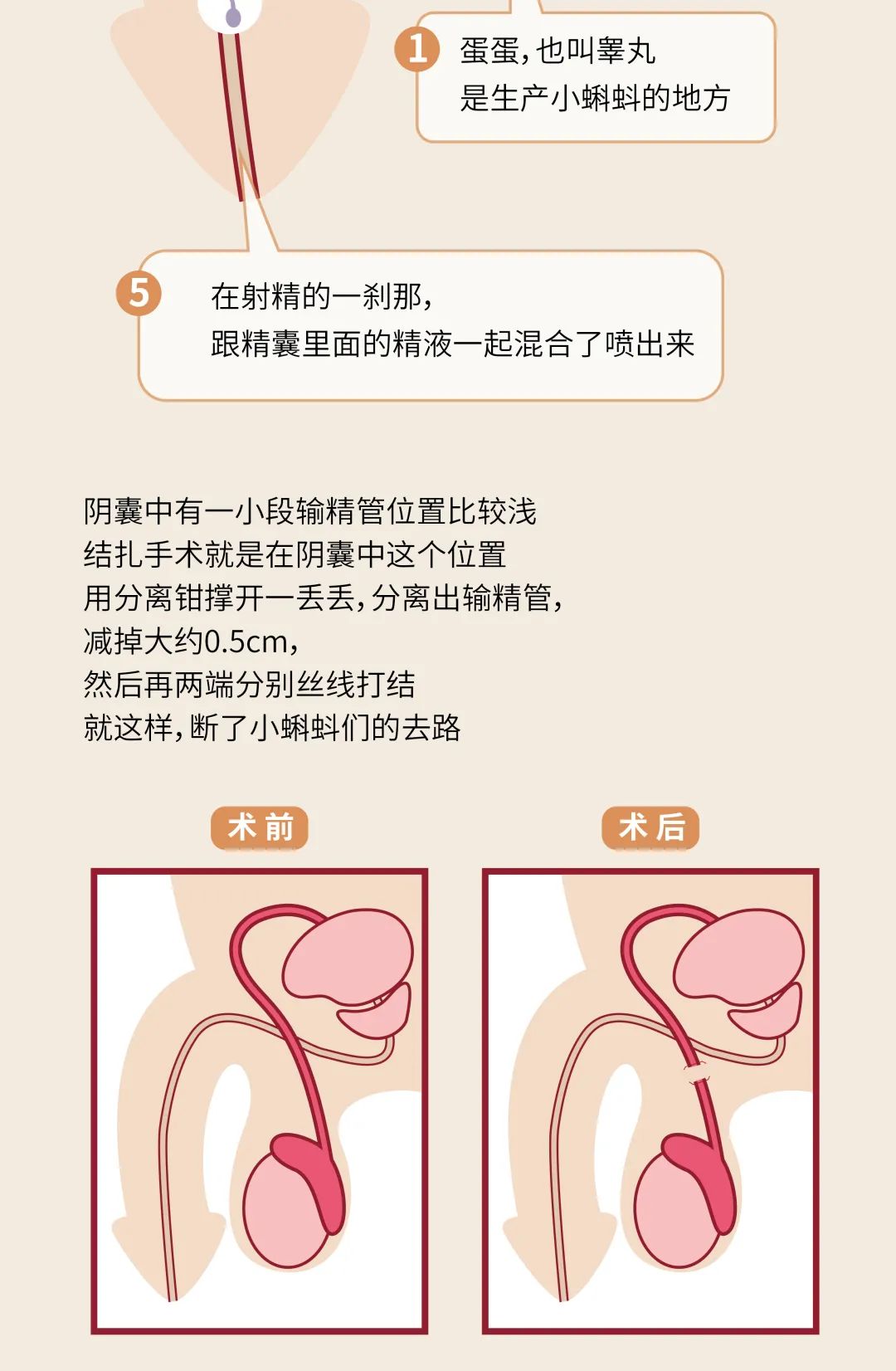 输精管有几条图片