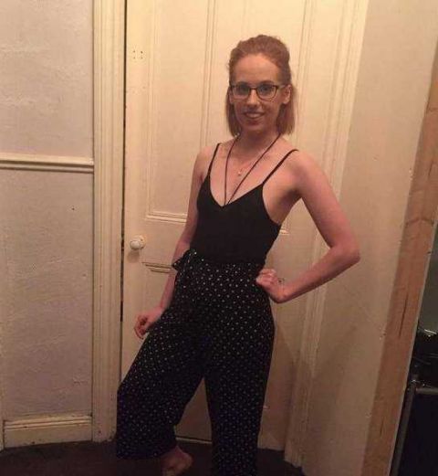 英国一女子减肥过度患厌食症,体重只有60斤,真正的皮包骨!