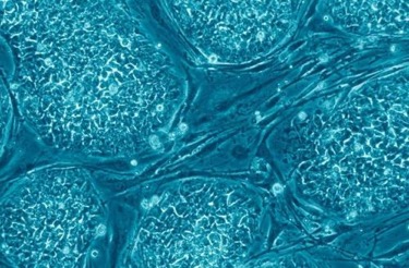 vsta干细胞美容技术论文(干细胞在整形修复美容领域研究和临床试验的专家共识)