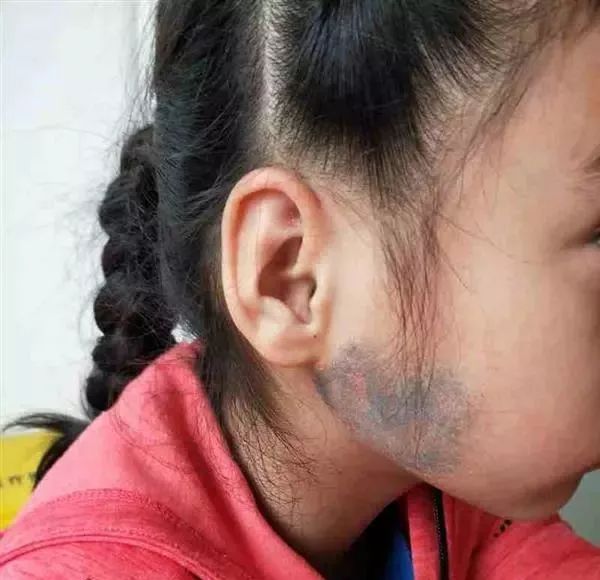 26岁壮小伙患上无精症,竟是因为5年前的这件事!