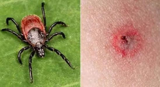 "我的皮肤,大脑都在遭受破坏!"贾斯丁·比伯自爆身患莱姆病,艾薇儿同