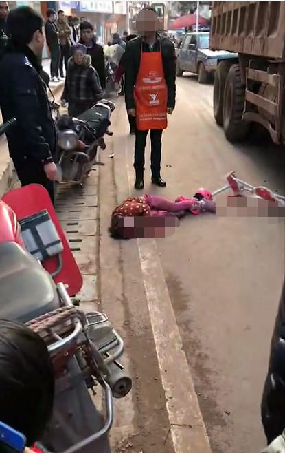 好可怜,宜宾一小女孩被大货车压了,其父母离异