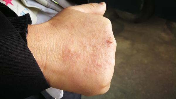 致敬!就是这只"丑陋"的手,为你腾出一条好走的路