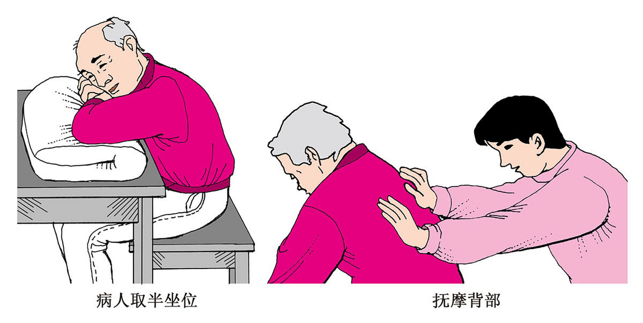 脑梗后,长期卧床患者,压疮,褥疮应该如何护理?