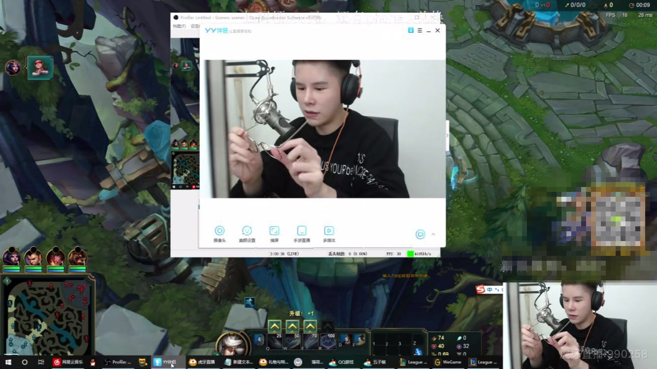 毒纪整容之后再次露脸直播,恢复情况超网友预期!小鲜肉成了?