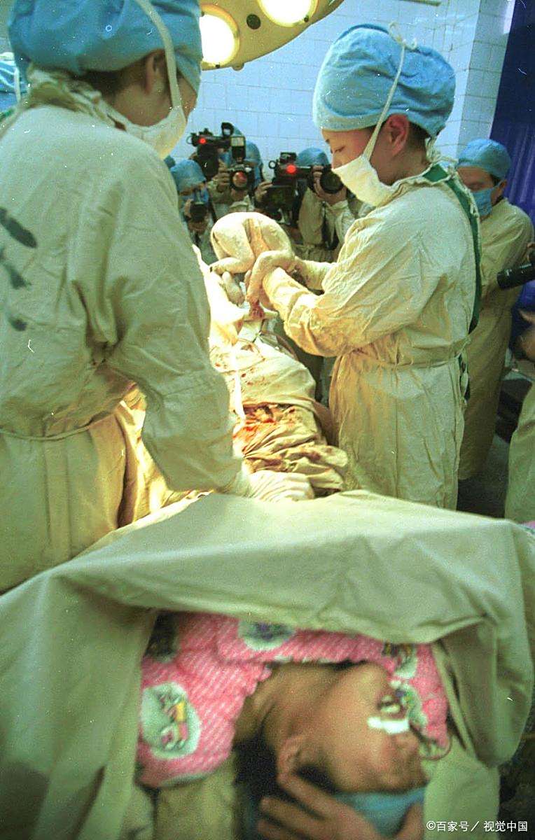 传统上,仰卧姿势是最常见的分娩姿势之一