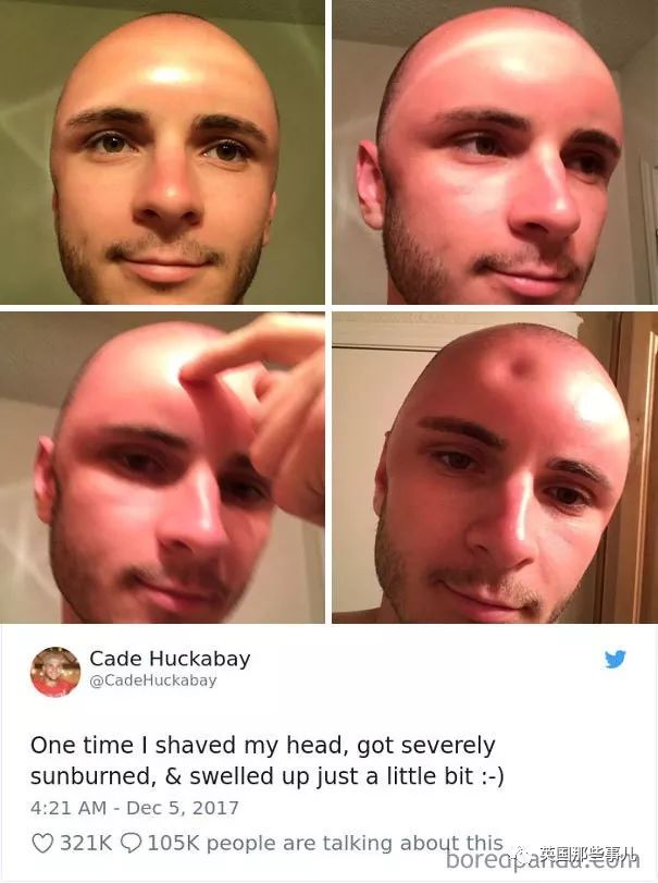 非要在大太阳天穿破洞牛仔裤!最近不开心的倒霉事儿有点多.