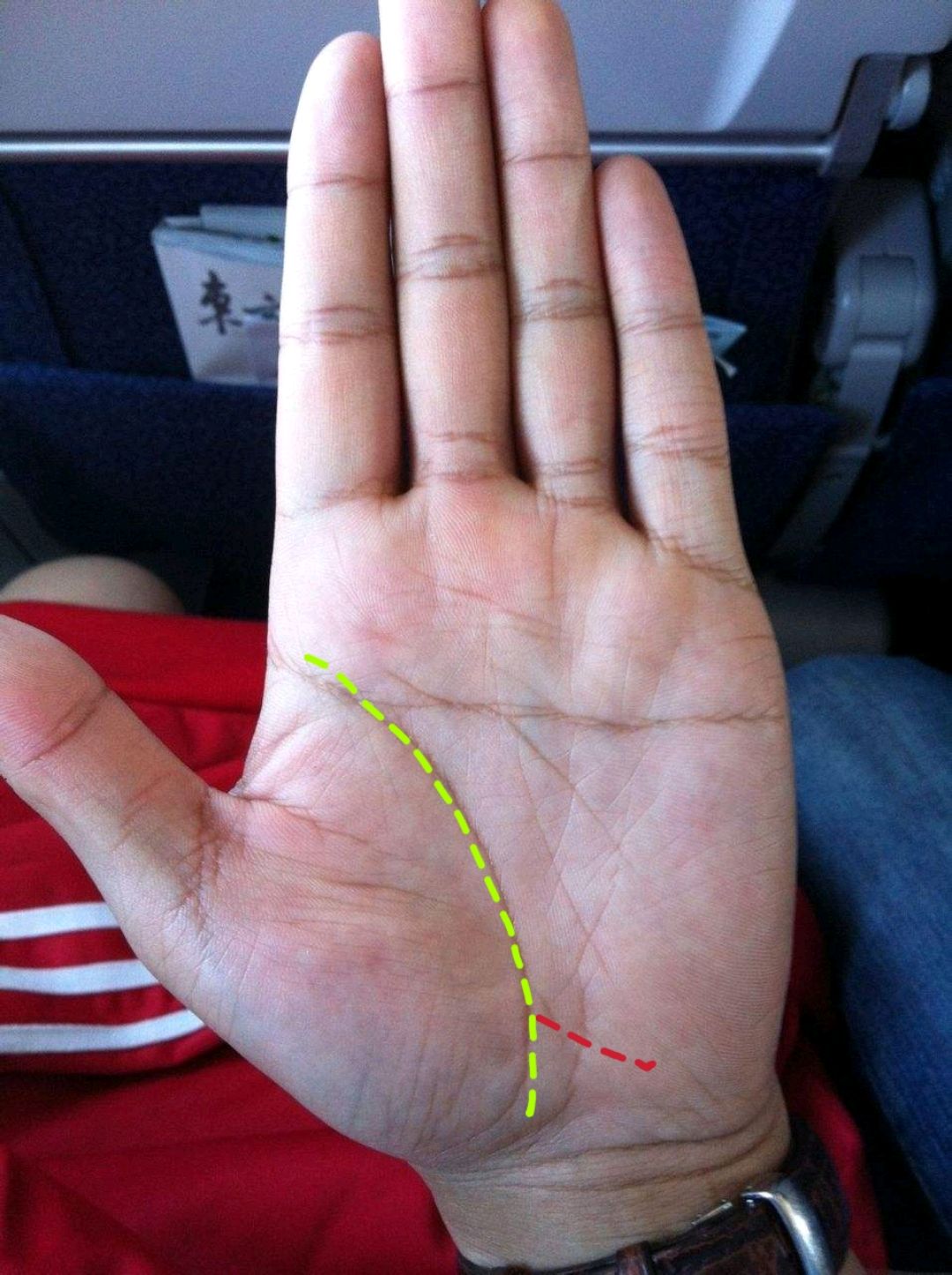 掌纹揭秘:便秘线给健康的提示