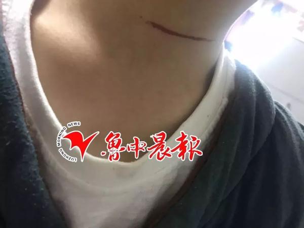 惊魂!在泉城广场看夜景差点遭风筝割喉:脖子火辣辣