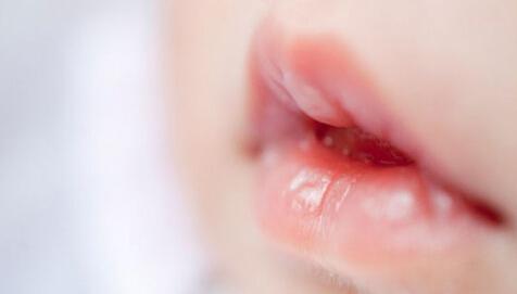 新生儿喝完奶嘴唇发白的原因,宝宝嘴唇颜色暗示身体状况