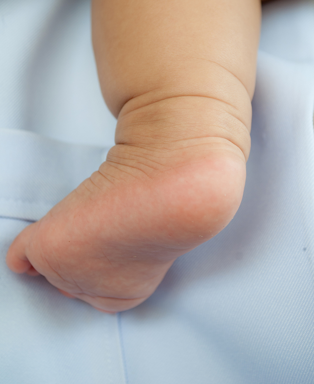 ⭐️很多宝宝出生后,家长会发现孩子的腿纹不对称,其实小腿纹不一