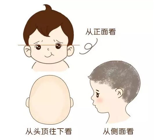 偏头?斜颈?宝宝头形不好看,妈妈没有这么做!