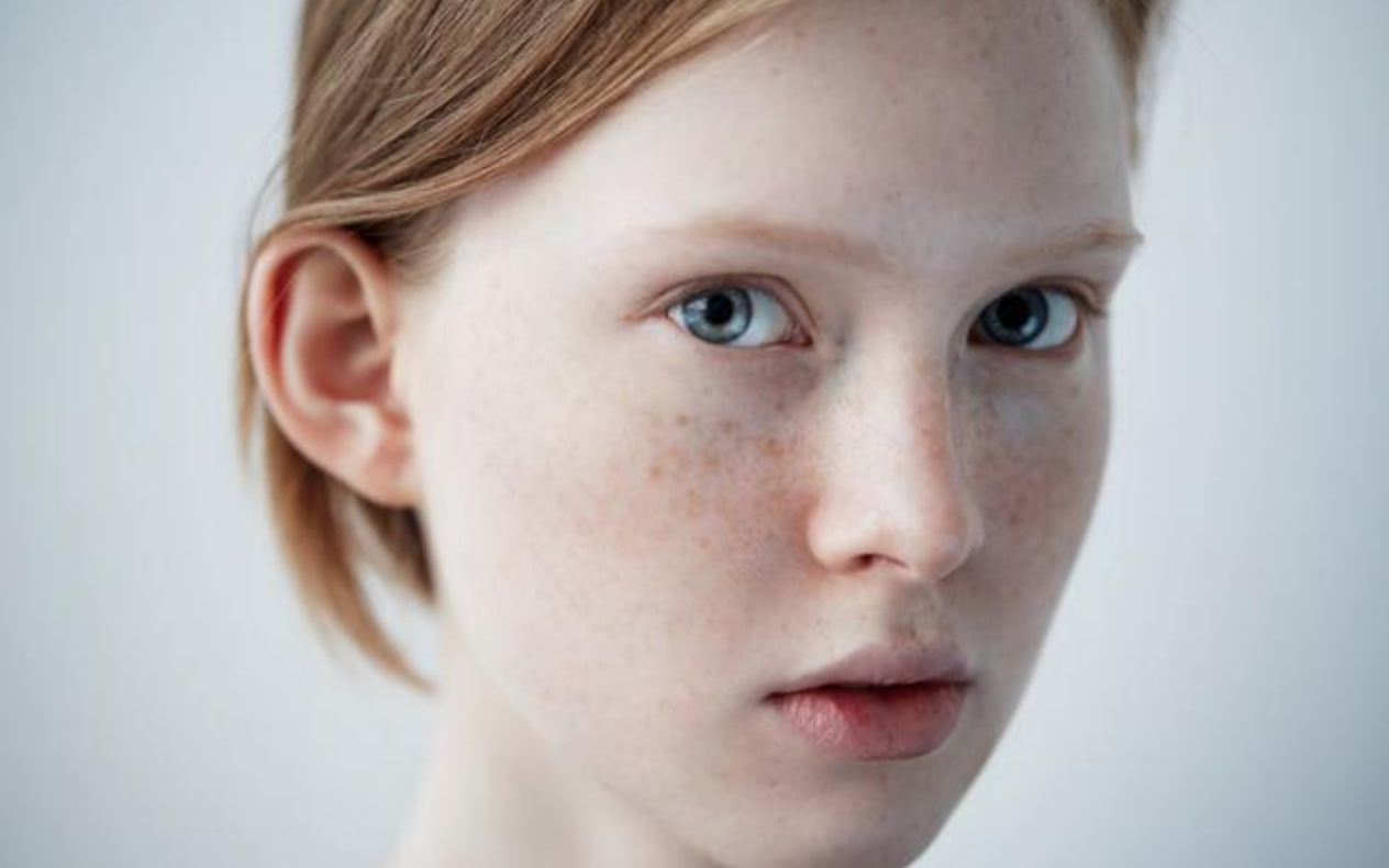 色斑"最怕"3道食谱,每天吃一点,美白皮肤,肌肤水润不显老