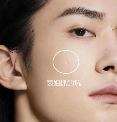 易烊千玺说出脸上疤痕的来历,得知真实原因后,网友:心疼一秒钟