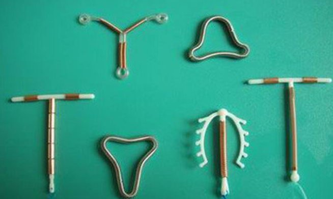 节育环取出后,有哪些需要注意的地方?不妨多了解一下吧