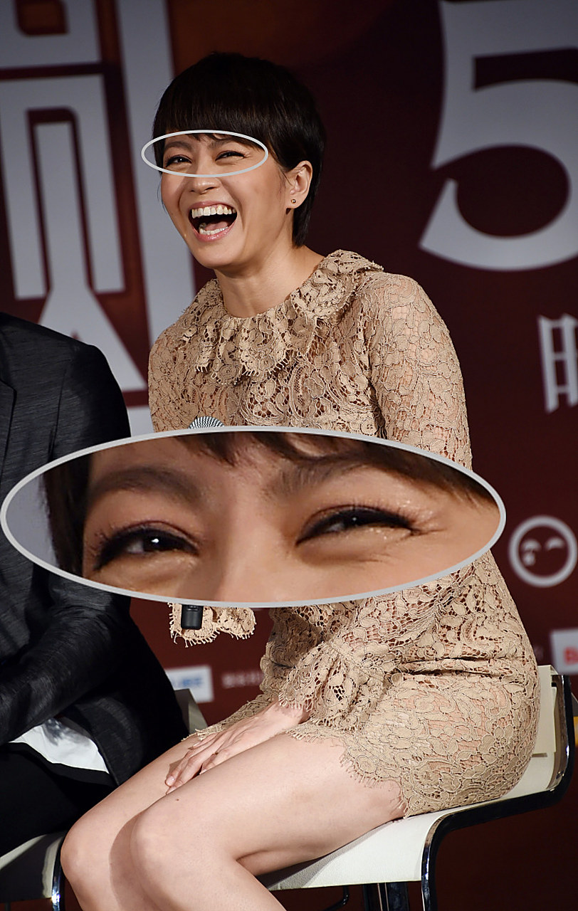 简单来说,鱼尾纹是表情肌长时间重复运动导致的,尤其是眼角处肌肉的