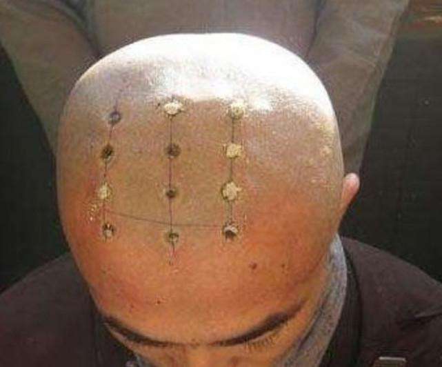 为什么和尚头顶必须点很多圆圈,是怎么刻上去的?看完涨知识了