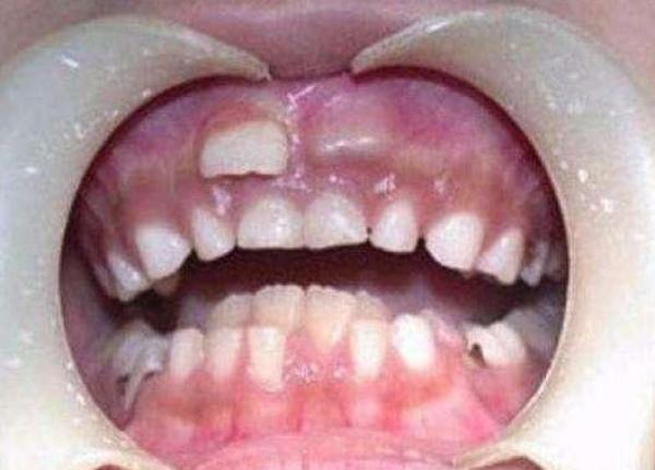 8岁孩子"4排"牙齿,医生检查出原因,父母听完双腿发软!