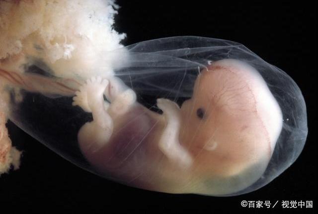 怀孕9周4天胎儿图片图片