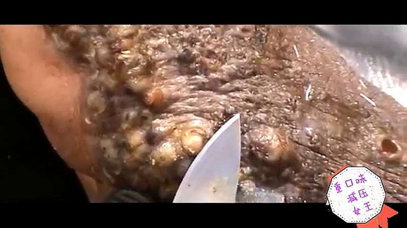 清除寄生在非洲人脚上的沙蚤卵,爆浆重口味14分钟,美食,美食猎奇,好看