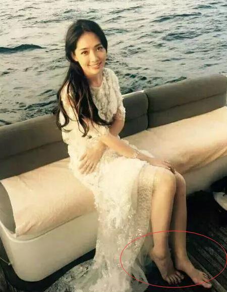 女星的脚好可怕!杨紫琼畸形,徐若瑄动手术,赵丽颖最心疼!