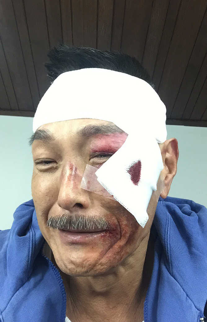 七位打星"伤妆照",吴京满臂淤痕,最后一位离世43年!