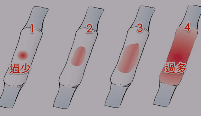 女人衰老的5大"信号",身体出现其中一个,你需要及时保养了
