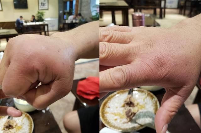 暴揍雷雷127拳,王知亮拳头浮肿,直言:雷雷的抗击打竟然这么强