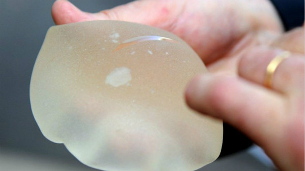 欧洲医学假体黑幕被揭 桔子水果都能获ce标签