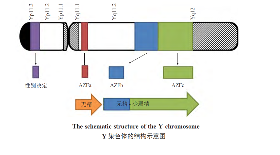 克氏综合征(47,xxy)与y染色体微缺失