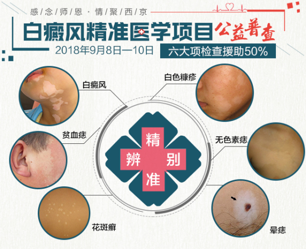 感恩师情,聚爱西京-白癜风精致公益普查即将开启