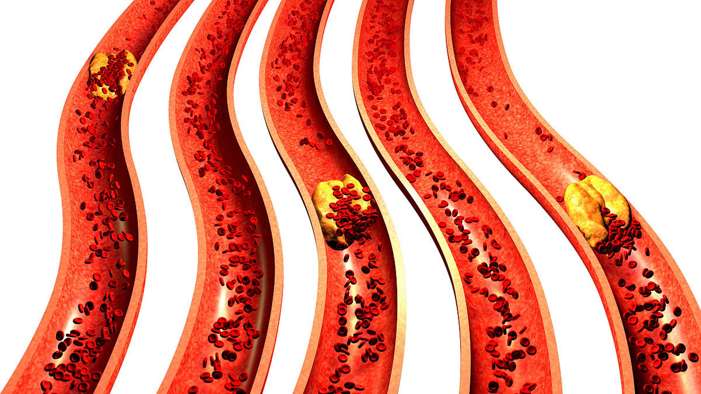 [微风]关注血管健康,软化血管吃这些[微风]  #健康经验笔记#   67