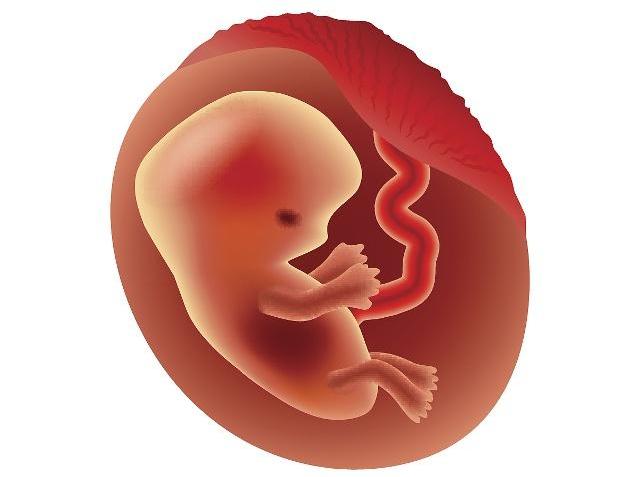 二个月胎儿图什么样子图片