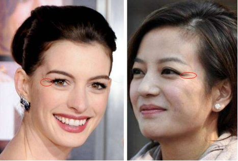 脸上有这4个迹象,那说明你可能开始变老了!看看你有几个?