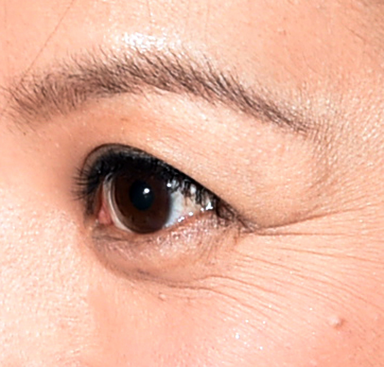 眼睛下有一道纹是什么纹 眼睛下面的纹可能是以下几