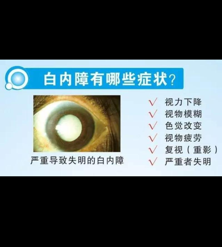 白内障症状