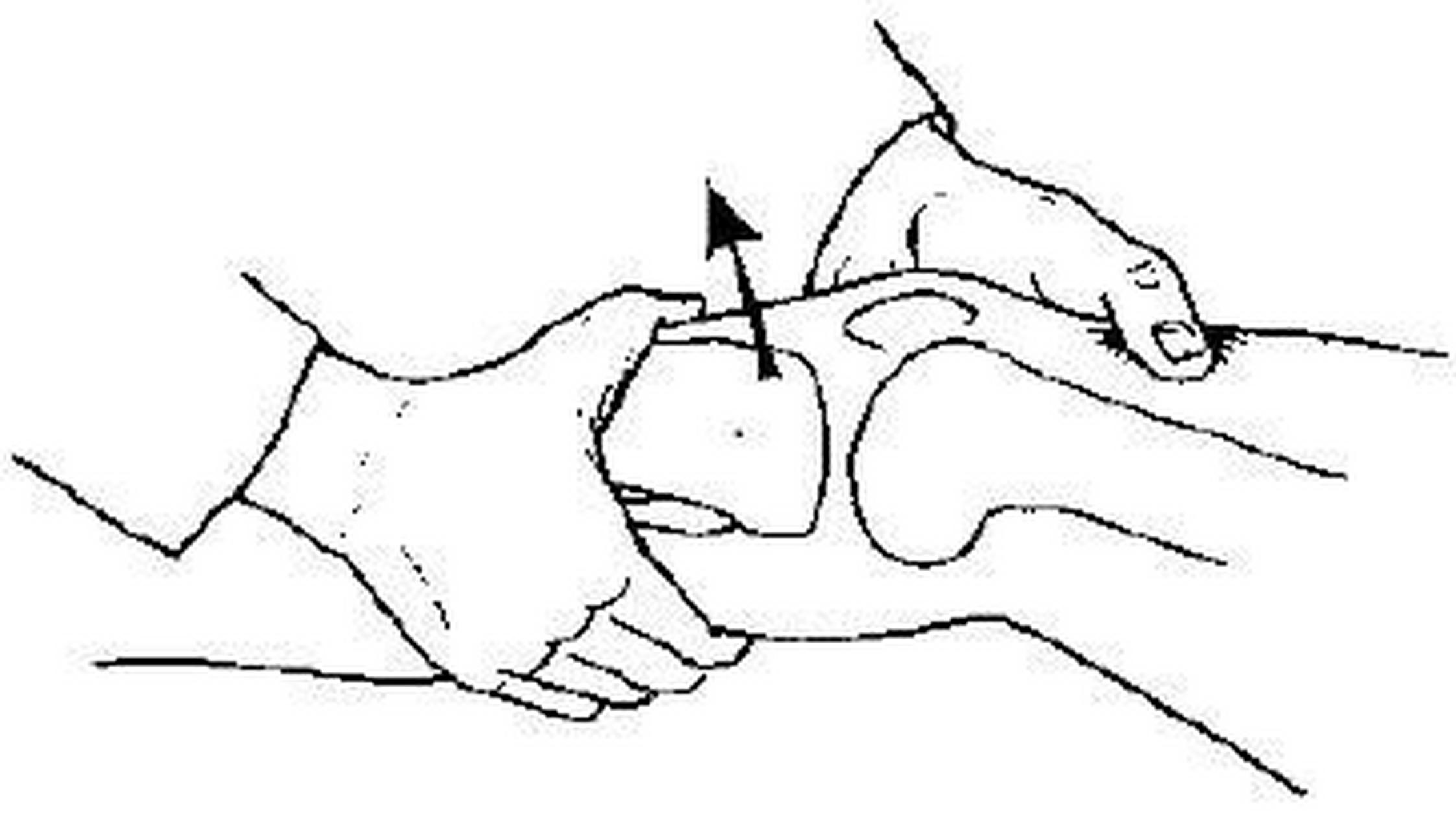 科普知识竞赛#抽屉试验又称推拉试验,是检查前交叉韧带损伤的常用