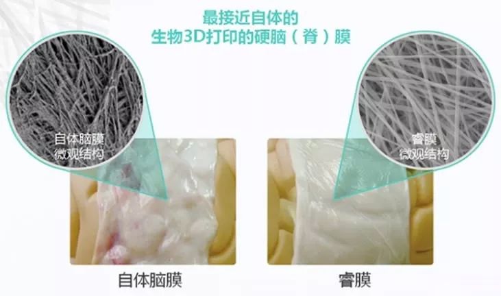生物3d 打印具有生物活性的人工硬脑膜「专利奖巡礼30」