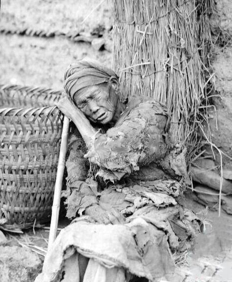 骨瘦如柴的孩子奄奄一息