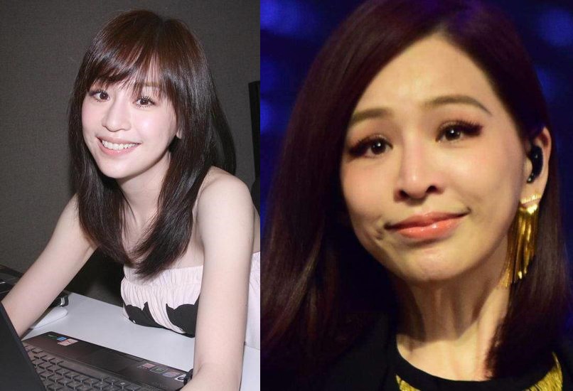 被玻尿酸毁了的女星,蔡明面部僵硬,李小璐像网红,她简直没法看