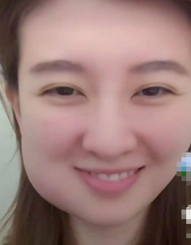 乔欣有多"惨"?看了她拔完智齿的"魔方脸",网友:笑出鼻涕泡