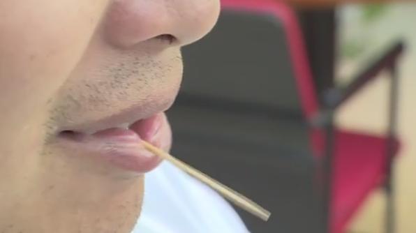 打盹误吞牙签!长沙一男子胃壁被扎穿