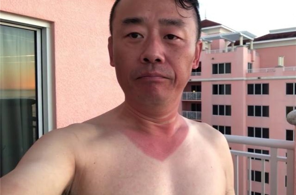 周立波罕见现身,国外日光浴晒红脖子,新发型显得痞气十足