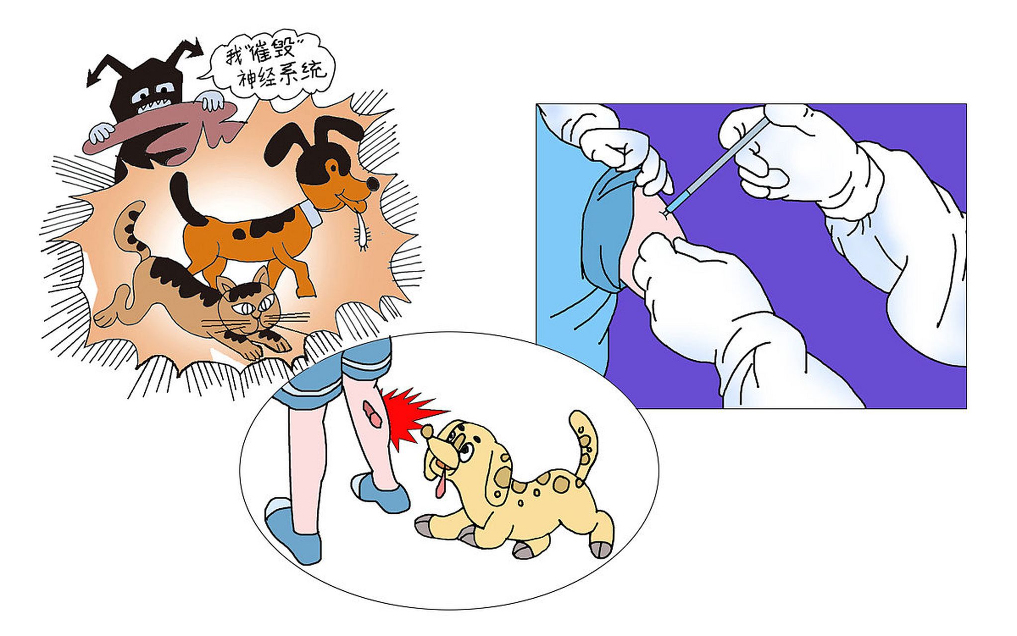 狂犬病暴露预防处置一般包括哪些措施?