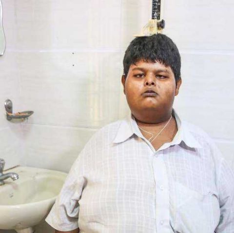 最胖的少年,印度15岁男孩体重300斤,3个月成功减肥90斤