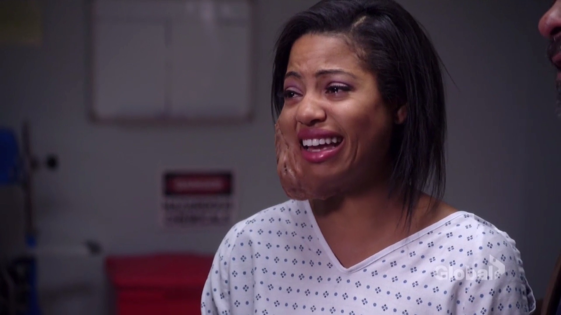 美剧:女孩脸上长了个大瘤子 家人却不让她割掉 说这是赐给她的!