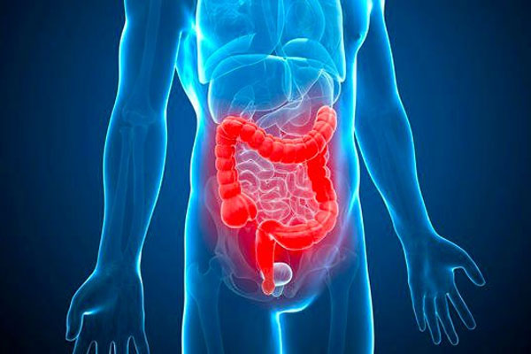 肠漏症是不是就是肠子漏出来了?为什么会发生肠漏?