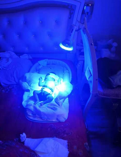 宝宝出生20天,住院照蓝光后,黄疸褪下又反弹原来是它惹的祸