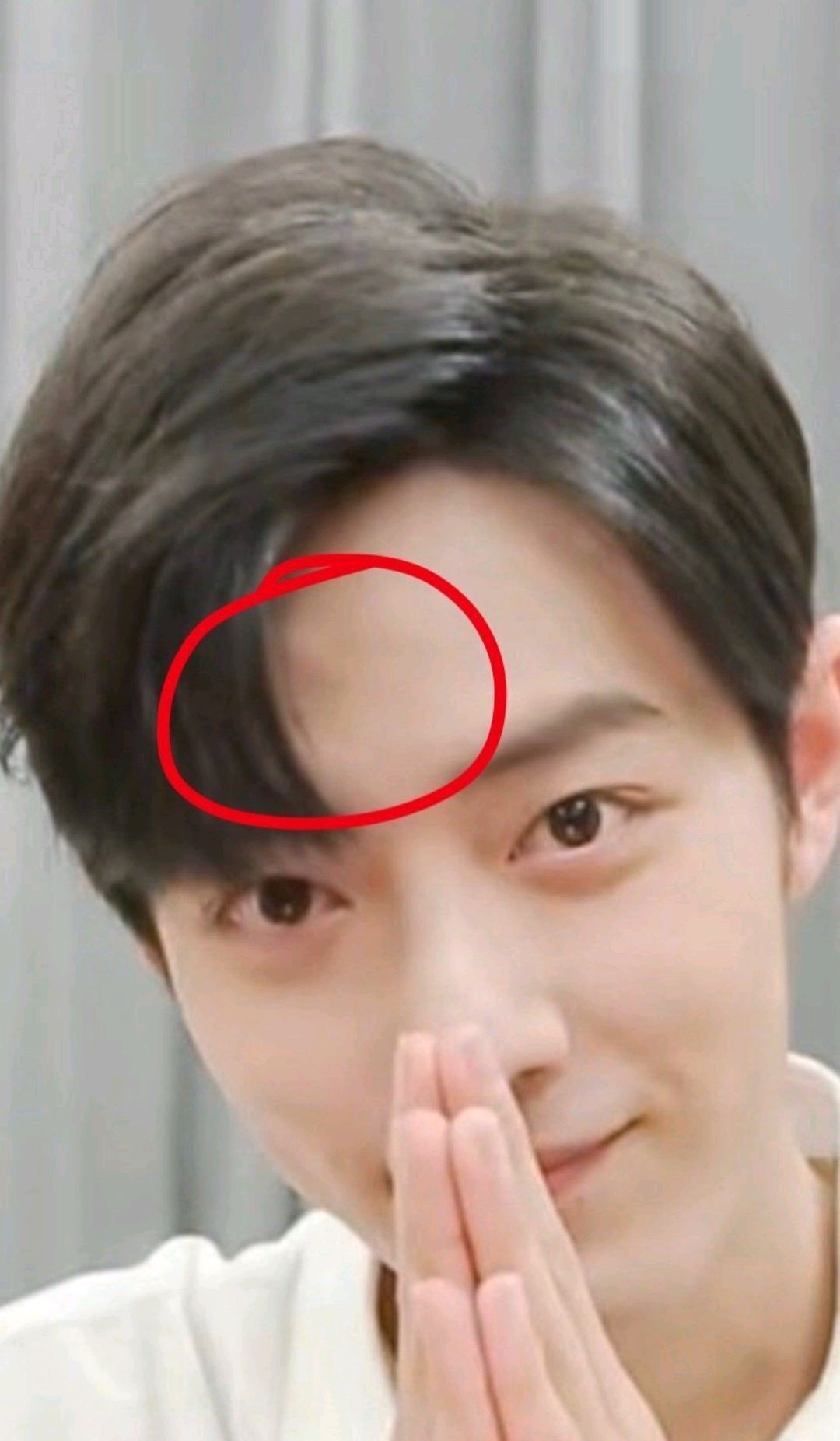 肖战头上磕大包?王一博个人信息泄露!私生饭到底有多特怕?