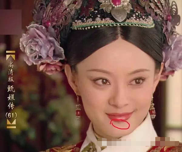 郑爽晒自拍嘴角疤痕抢镜 孙俪下巴有痣 小残缺才造就真美女